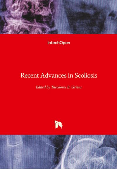 Recent Advances in Scoliosis - Theodoros Grivas