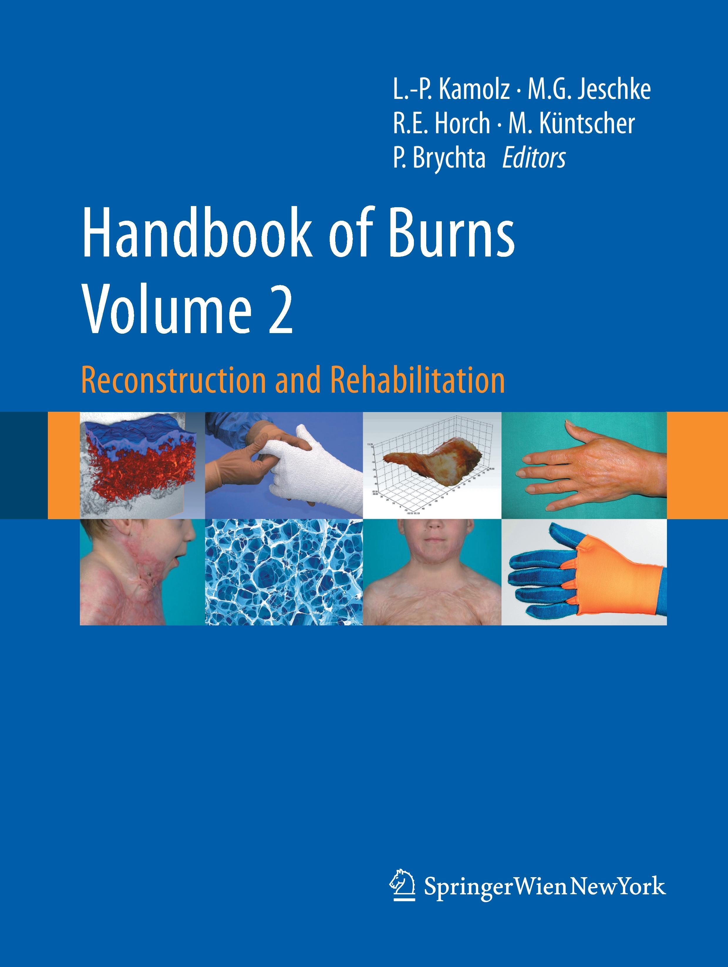 Handbook of Burns Volume 2 - Kamolz, Lars-Peter|Jeschke, Marc G.|Horch, Raymund E.|Küntscher, Markus|Brychta, Pavel