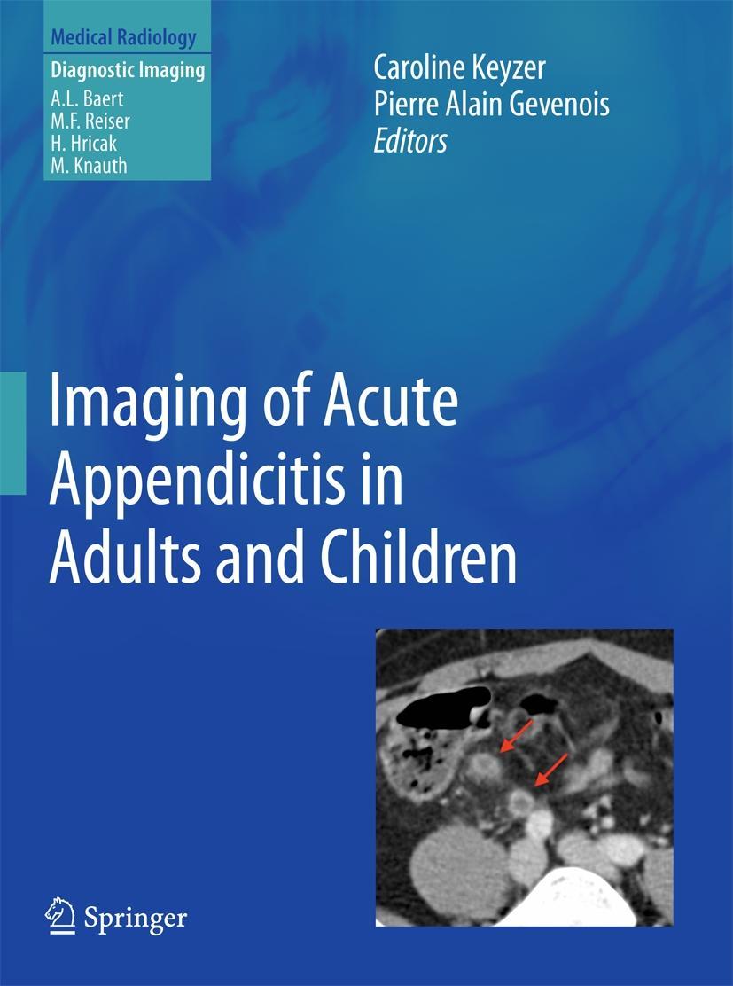 Imaging of Acute Appendicitis in Adults and Children - Keyzer, Caroline|Gevenois, Pierre A.