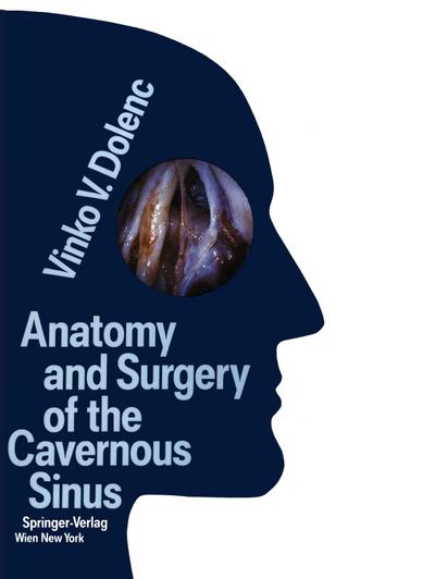 Anatomy and Surgery of the Cavernous Sinus - Vinko V. Dolenc