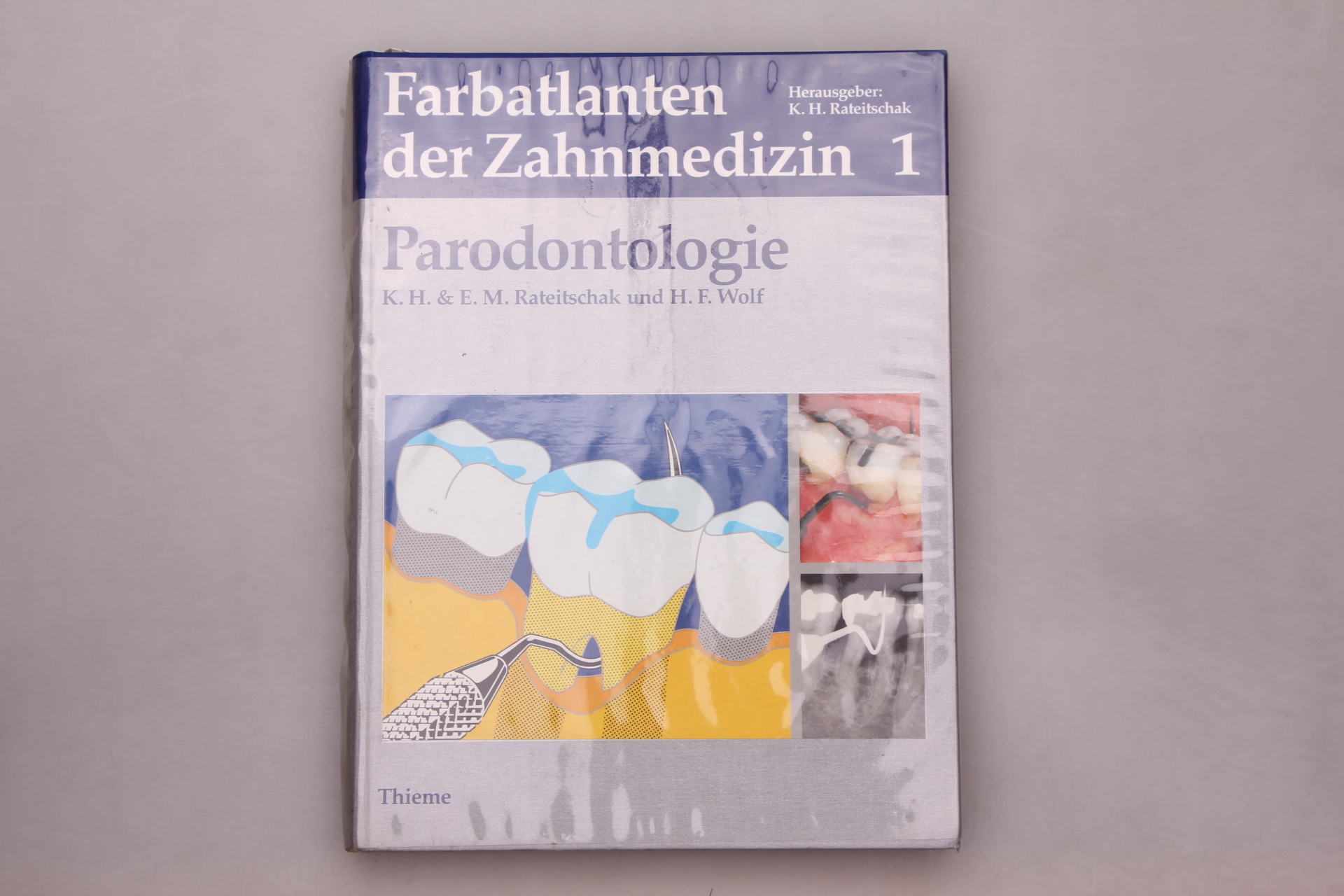 FARBATLANTEN DER ZAHNMEDIZIN 1 - PARODONTOLOGIE. - Rateitschak, K. H.; Rateitschak, E. M.; Wolf, H. F.;