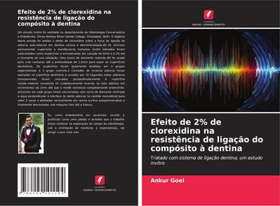 Efeito de 2% de clorexidina na resistência de ligação do compósito à dentina : Tratado com sistema de ligação dentina; um estudo invitro - Ankur Goel