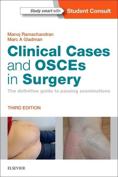 Clinical Cases and OSCEs in Surgery : The definitive guide to passing examinations - Manoj (Consultant Paediatric and Young Adult Orthopaedic Surgeon Ramachandran, William Harvey Research Institute Honorary Senior Lecturer