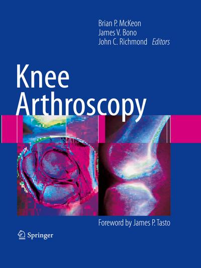 Knee Arthroscopy - Brian P. McKeon