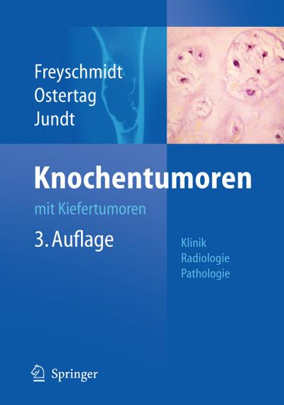 Knochentumoren mit Kiefertumoren : Klinik - Radiologie - Pathologie - Jürgen Freyschmidt