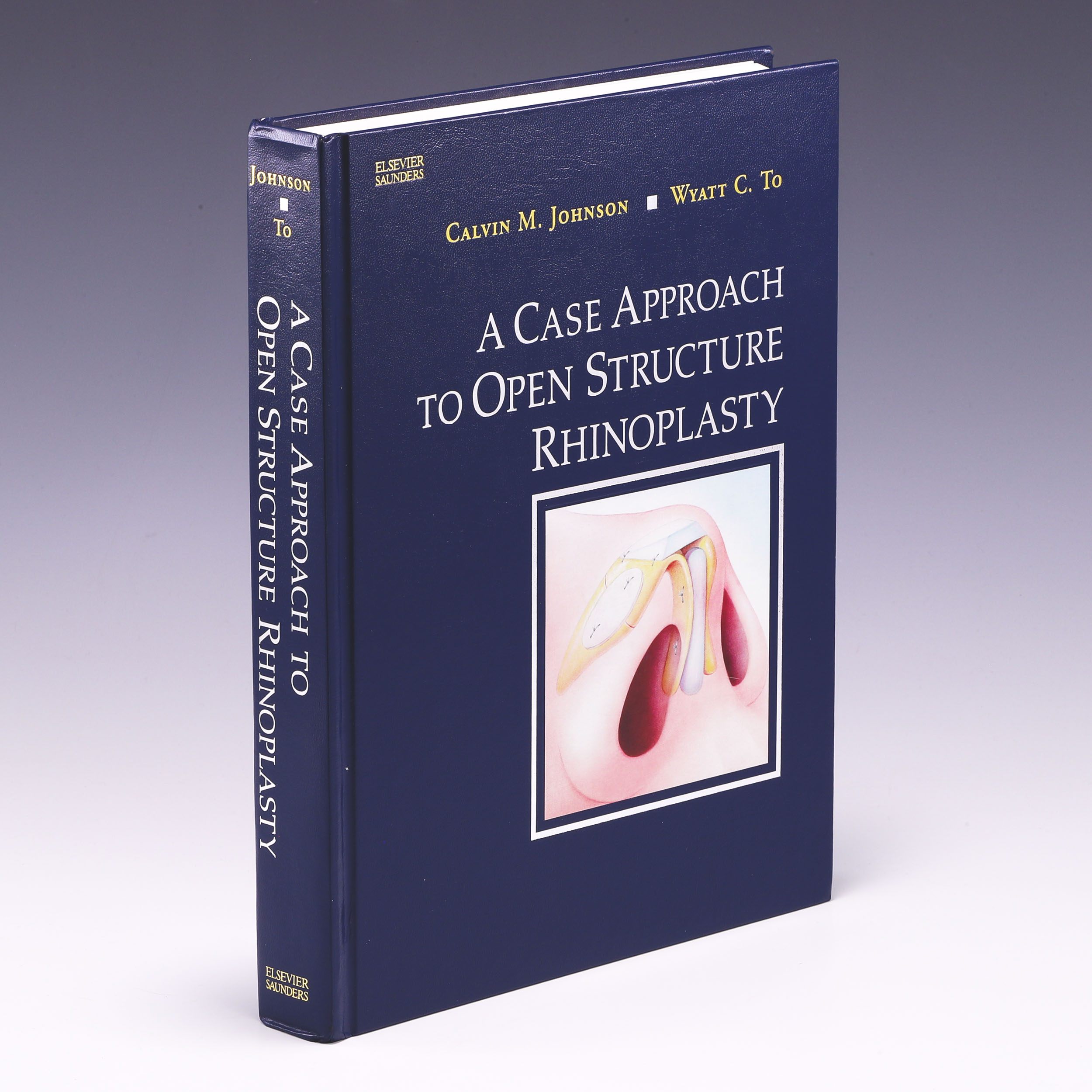 A Case Approach to Open Structure Rhinoplasty - Calvin M. Johnson Jr. MD & Wyatt C. To MD