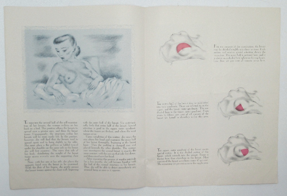Self Examination of the Female Breast by American Cancer Scoiety: Very Good  Paperback (1951)