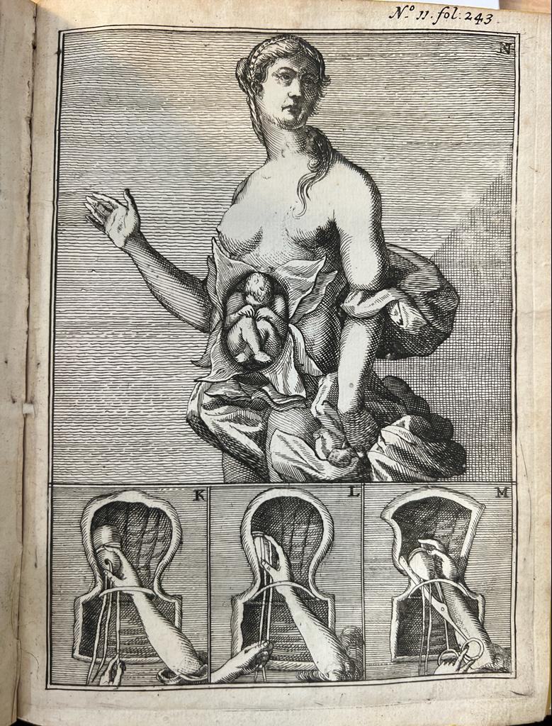 [Medical, midwife, 1691] Spiegel der vroed-vrouwen, behelsende een klaer onderrigt van sware verlossingen der kramende vrouwen (.) neffens een klaer
