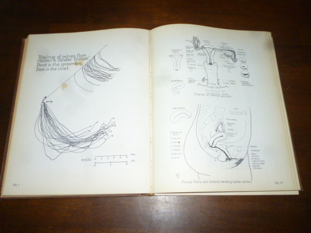 Atlas of Human Sex Anatomy by Robert Latou Dickinson 1958