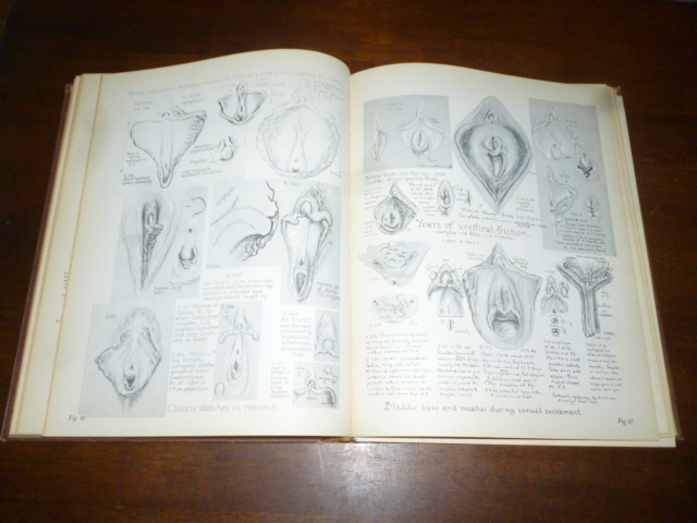 人体性解剖学図説 Atlas of Human Sex Anatomy
