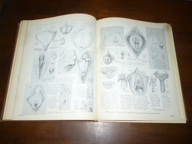 Atlas of Human Sex Anatomy