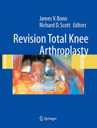 Revision Total Knee Arthroplasty - James V Bono