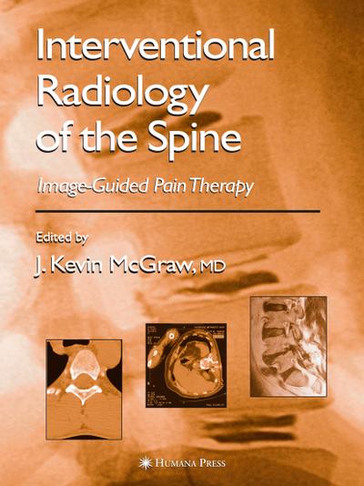 Interventional Radiology of the Spine: Image-Guided Pain Therapy - J. Kevin McGraw