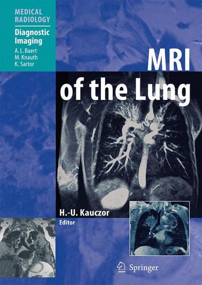 MRI of the Lung, - H.-U. (Ed.) Kauczor