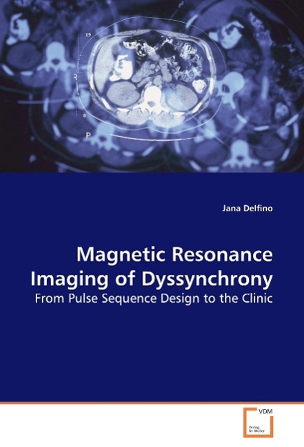 Magnetic Resonance Imaging of Dyssynchrony - Jana Delfino