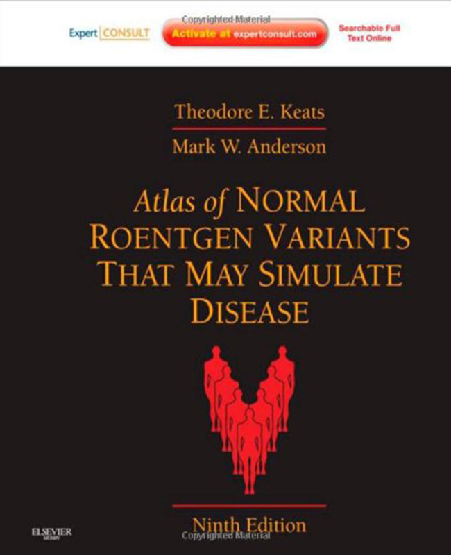 Atlas Of Normal Roentgen Variants That May Simulate Disease - Enhanced Online Features And Print - Keats