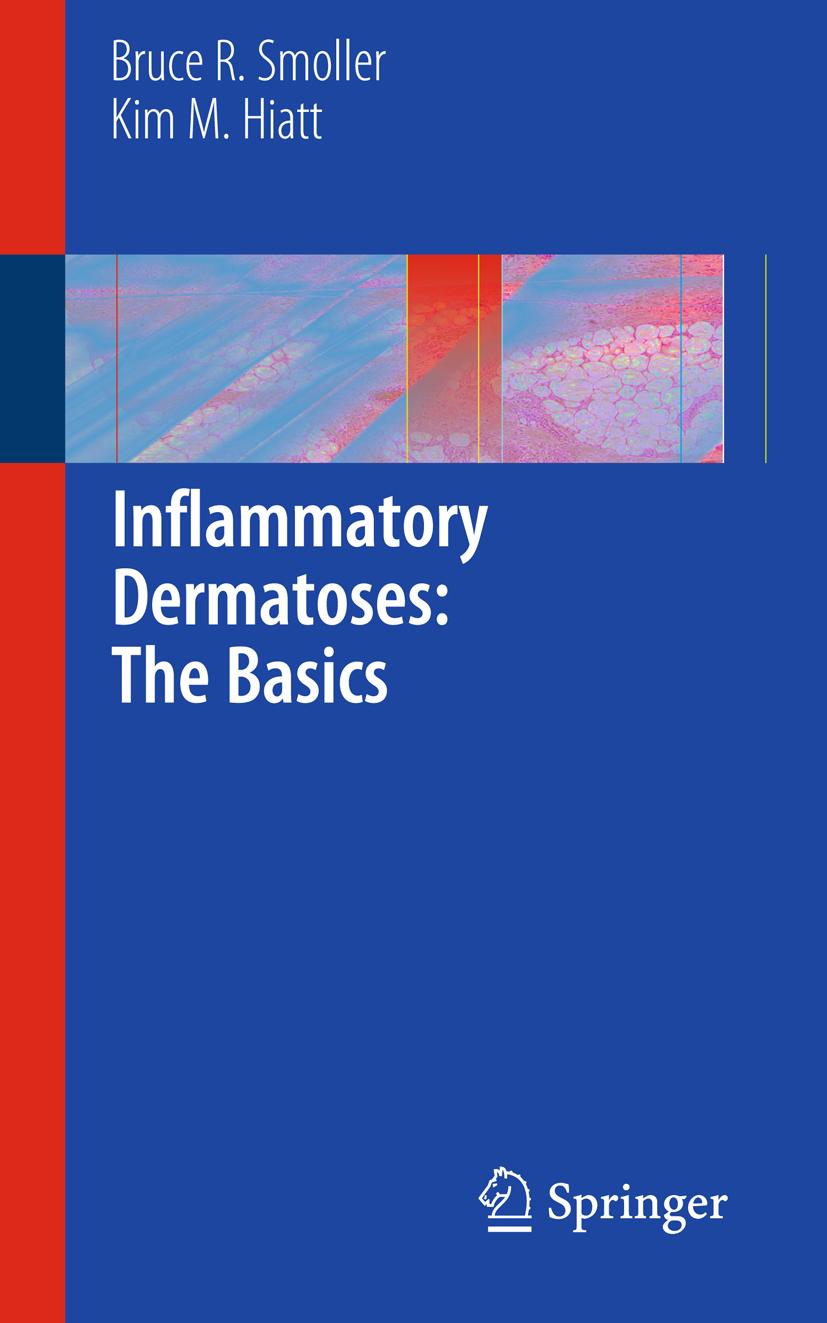 Inflammatory Dermatoses: The Basics - Bruce R. Smoller|Kim M. Hiatt