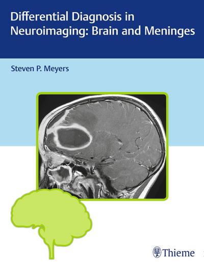 Differential Diagnosis in Neuroimaging: Brain and Meninges - Steven P. Meyers