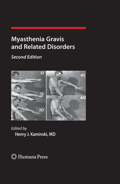 Myasthenia Gravis and Related Disorders - Henry J. Kaminski