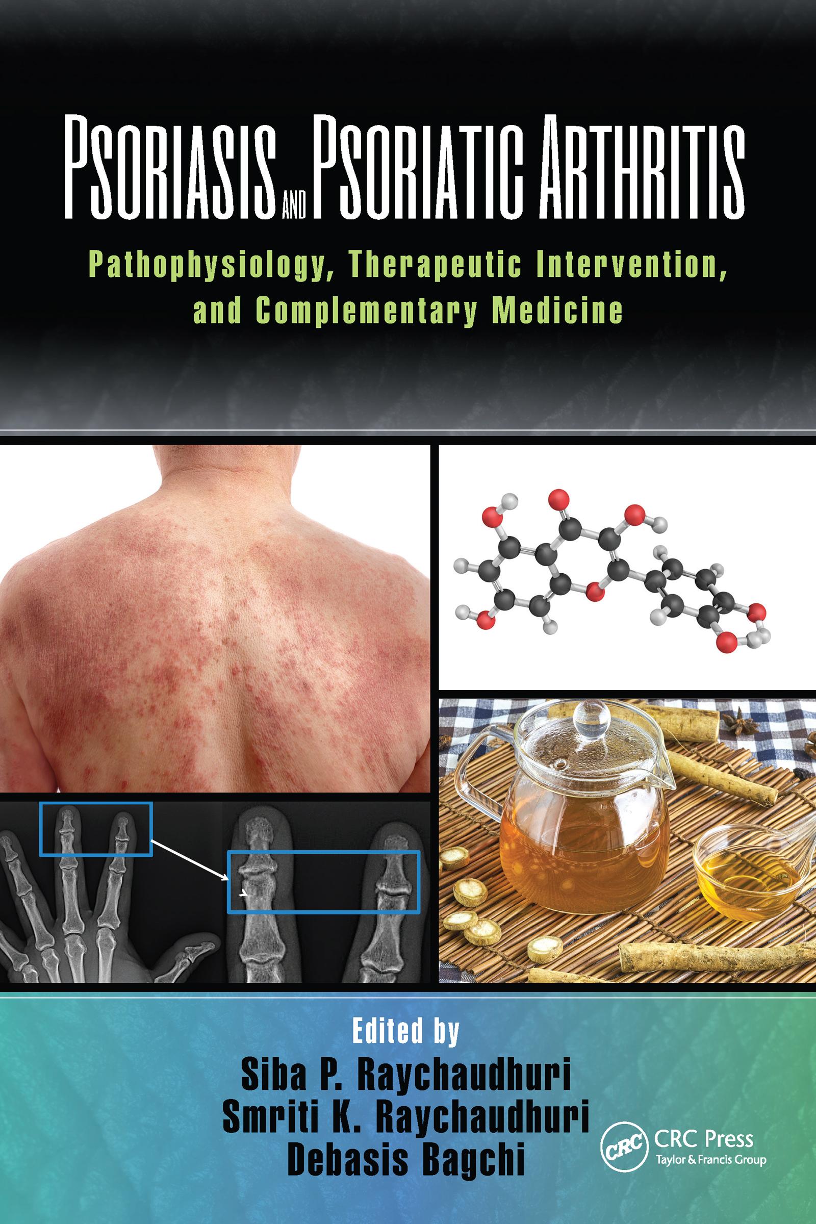 Psoriasis and Psoriatic Arthritis