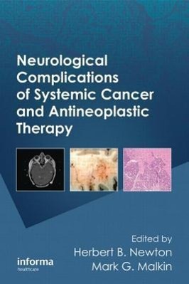 Neurological Complications of Systemic Cancer and Antineopla - Newton, Newton B.|Newton, Herbert B.