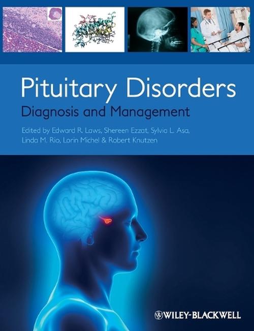 Pituitary Disorders (Paperback) - Edward R. Laws