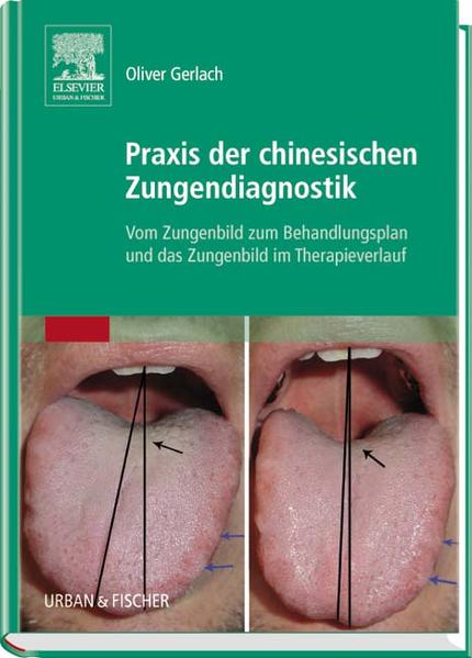 Praxis der chinesischen Zungendiagnostik: Vom Zungenbild zum Behandlungsplan und das Zungenbild im Therapieverlauf - Gerlach, Oliver