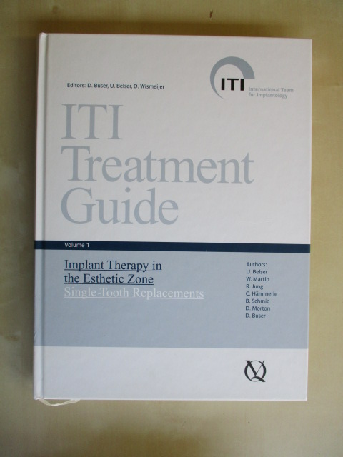 ITI Treatment Guide, Volume 1. Implant ITI Treatment Guide, Volume 1. Implant