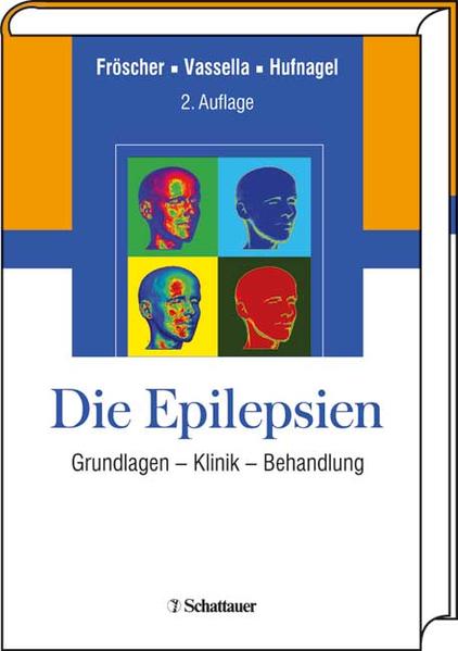 Die Epilepsien: Grundlagen - Klinik - Behandlung - Fröscher, Walter, Franco Vassella und Andreas Hufnagel