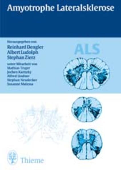 Amyotrophe Lateralsklerose - Dengler, Reinhard; Ludolph, Albert C.; Zierz, Stephan; Karitzky, Jochen; Lindner, Alfred; Malessa, Susanne