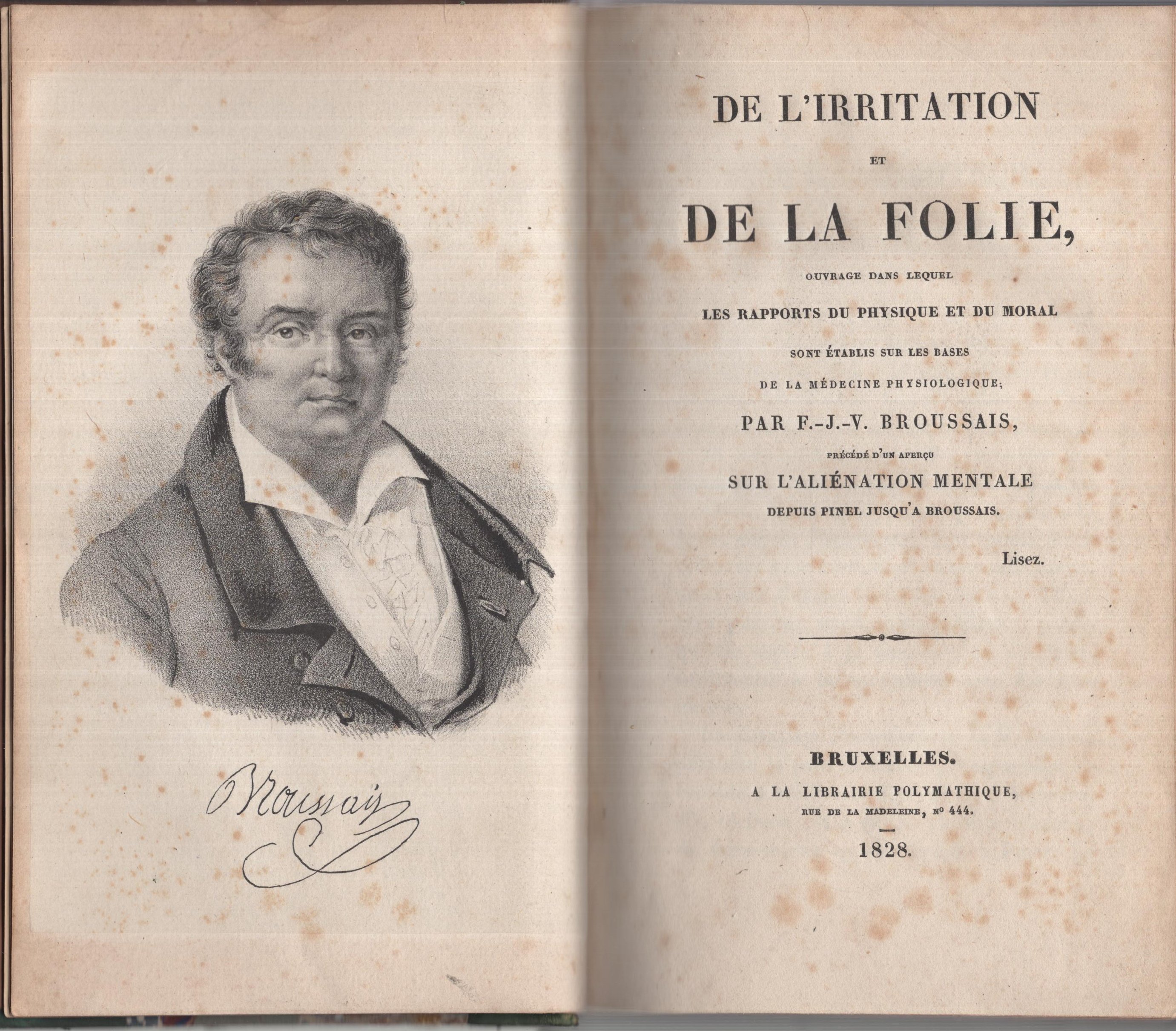 De L'irritation Et …