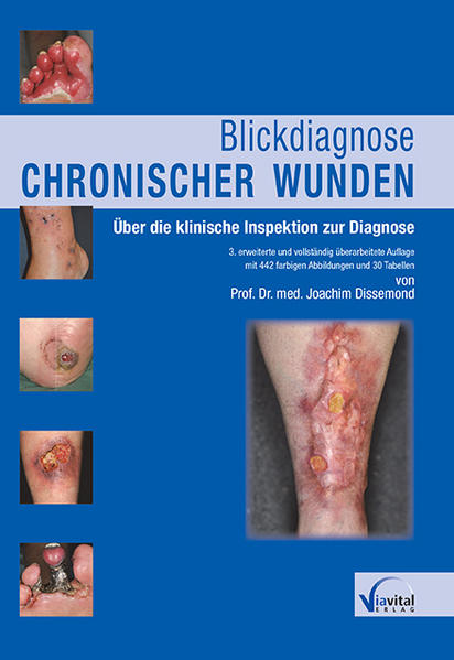 Blickdiagnose chronischer Wunden: Über die klinische Inspektion zur Diagnose - Dissemond, Joachim