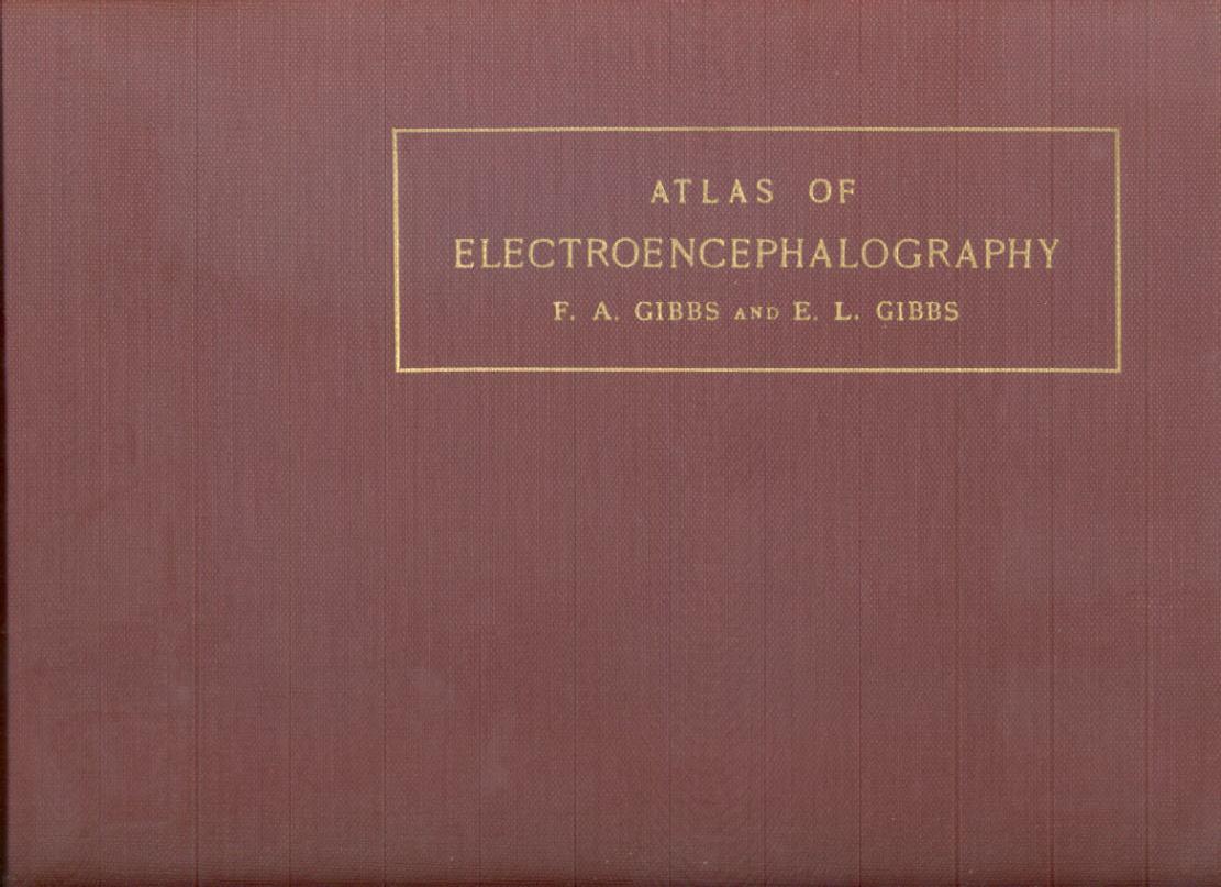Atlas of electroencephalography:The Epilepsies. EEG and
