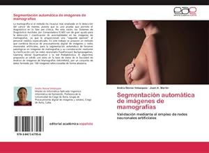 Bild des Verkufers fr Segmentacin automtica de imgenes de mamografas : Validacin mediante el empleo de redes neuronales artificiales zum Verkauf von AHA-BUCH GmbH