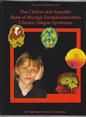 Bild des Verkufers fr The Clinical and Scientific Basis of Myalgic Encephalomyelitis/Chronic Fatigue Syndrome zum Verkauf von Riverwash Books (IOBA)