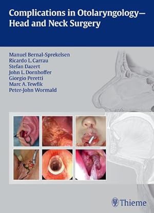 Immagine del venditore per Complications in Otolaryngology - Head and Neck Surgery venduto da BuchWeltWeit Ludwig Meier e.K.