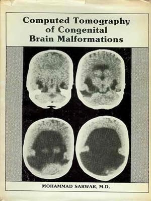 Bild des Verkufers fr Computed Tomography of Congenital Brain Malformations zum Verkauf von Bookmarc's