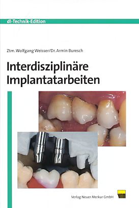 Seller image for Interdisziplinre Implantatarbeiten. dl-Technik-Edition. for sale by Fundus-Online GbR Borkert Schwarz Zerfa