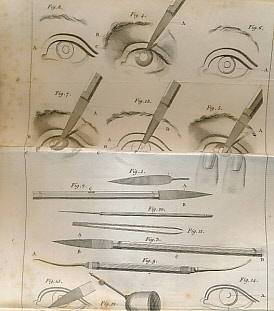 Image du vendeur pour A Treatise on the Cataract; with Cases to Prove the Necessity of Dividing the Transparent Cornea, and the Capsule of the Crystalline Humour, Differently, in the Different Species of the Disease. [bound with] A Treatise on the Extraction of the Cataract mis en vente par Barter Books Ltd