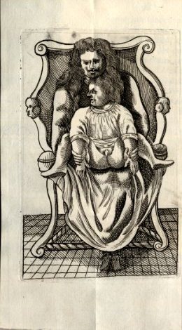 Bild des Verkufers fr Dissertatio lithologica variis observationibus et figuris illustrata. zum Verkauf von Antiq. F.-D. Shn - Medicusbooks.Com
