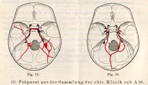Imagen del vendedor de Ueber Fracturen der Schdelbasis. a la venta por Antiq. F.-D. Shn - Medicusbooks.Com
