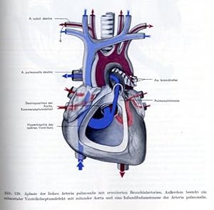 Missbildungen des menschlichen Herzens. Entwicklungsgeschichte und Pathologie.