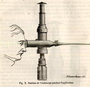 De l'endoscope et de des application (pp.596-609, 2 Abb.).