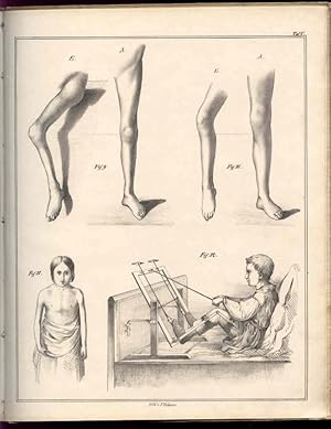 Beobachtungen über Lähmungszustände der untern Extremitäten und deren Behandlung.