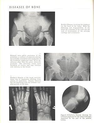 Principles of Roentgenological Interpretation ; with addition of a chapter on radiation therapy.