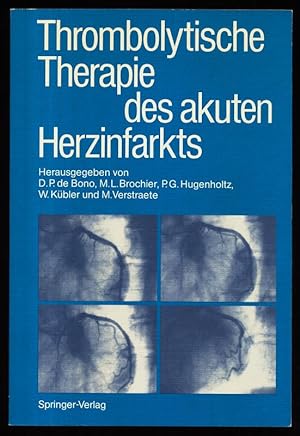 Seller image for Thrombolytische Therapie des akuten Herzinfarkts. for sale by Antiquariat Peda