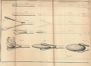 Image du vendeur pour Principles of Lithotricity; or, A Treatise on the Art of Extracting the Stone Without Incision mis en vente par Barter Books Ltd