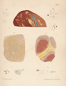 Image du vendeur pour Atlas of Pathological Anatomy Illustrative of A Clinical Treatise of Diseases of the Liver. Parts I and II mis en vente par Barter Books Ltd