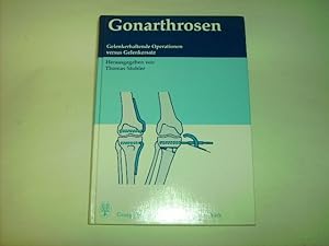 Seller image for Gonarthrosen. Gelenkerhaltende Operationen versus Gelenkersatz. for sale by Der-Philo-soph