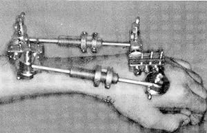 Immagine del venditore per The Wrist and its disorders [Basic science -- The development of wrist surgery : An historical review -- Anatomy of the wrist -- Vascularity of the carpus -- Weist mechanics and its association with ligamentous instability -- Pathogenesis of wrist ligament instability -- Evaluation -- Physical examination of the wrist -- Roentgenographic diagnosis of wrist pain and instability -- Soft tissue radiography of t he wrist -- Wrist arthroscopy -- Clinical applications of wrist arthroscopy -- Trauma-related conditions and their treatment -- Acute fractures and dislocations of the carpus -- Unstable fractures of the distal radius -- THe trepexiomtacarpal joint : Basic principles of surgical treatment -- The caropmetacarpal joint of the thumb ] venduto da Joseph Valles - Books